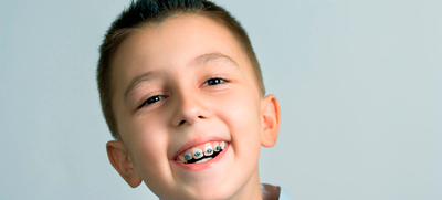 До скількох років можна ставити брекети для вирівнювання зубів дитині, коли краще встановлювати дітям, в якому віці дорослим
