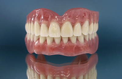 Імплантація верхніх зубів, повна заміна та протезування щелепи, зубний імплант на місце видалених