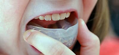 Кап для виправлення прикусу у дітей і дорослих, можна дитині користуватися дитячої нічний зубний капою для вирівнювання