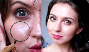 Як позбутися від жирної шкіри на обличчі: правила догляду, використання народних засобів