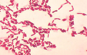 Бактеріальний рак винограду: лікування бактеріозу, симптоми профілактика та фото