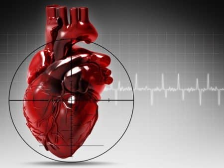 Особливості проведення і розшифровка ЕКГ при інфаркті міокарда