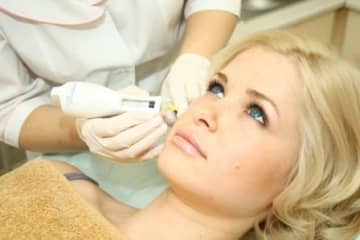 Стек гілок ліфтинг шкіри обличчя — плюси і мінуси ефективної процедури омолодження
