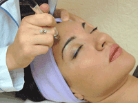Криомезотерапия — одна з кращих омолоджуючих методик в косметології