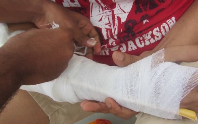 Надання першої допомоги при переломі руки: симптоми і види переломів
