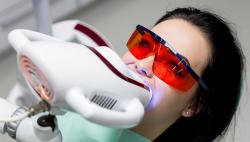 Показання до застосування механічного відбілювання зубів, види відбілювання.