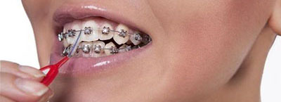 Щітка для брекетів: чистка та догляд за зубами спеціальної, зубний ортодонтичної, електричної Орал Бі Oral b, Колгейт Орто, фото
