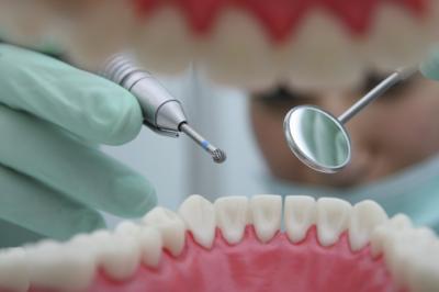 Стоматит після видалення зуба мудрості: чи можна лікувати при прорізуванні, зубна паста від стоматолога, щоб чистити у роті