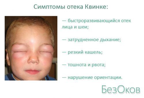 Реакція на укуси комарів у дітей