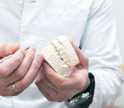 Імплантація передніх зубів: які імпланти поставити на передні верхні і нижні, особливості одномоментного протезування
