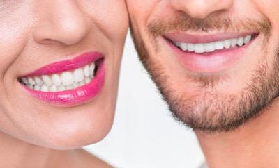 Відбілювання зубів White Smile: косметична пудра, паста та інше в системі Вайт Смайл