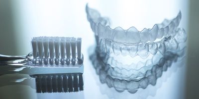 Брекети або капи: що краще для вирівнювання зубів, коли можна ставити замість елайнерів і чим вони відрізняються