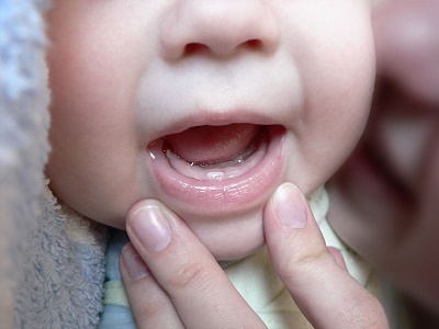 Молочний прикус: що це таке, скільки зубів у ранньому змінному прикусі, формула тимчасових у дітей, зубна таблиця