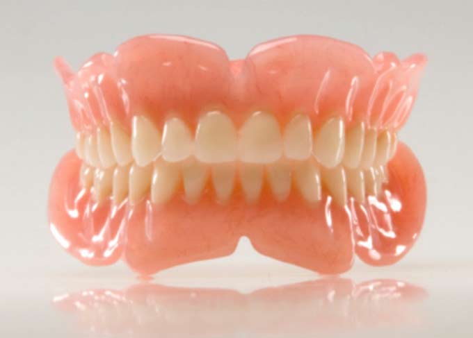 Зубні протези на присосках: відмінності, переваги та недоліки