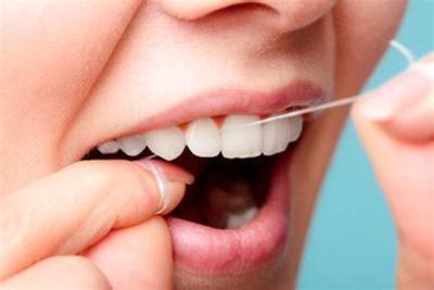 Догляд за імплантами зубів після установки: як доглядати за порожниною рота, як чистити іригатором після операції імплантації