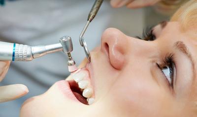 Чистка перед брекетами: що потрібно знати та зробити перед установкою, підготовка до процесу, що роблять з зубами під час процедури