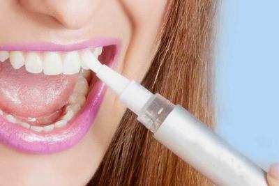 Олівець для відбілювання зубів: як користуватися маркером, коли не можна використовувати фломастер, марки Luxury white і Pen