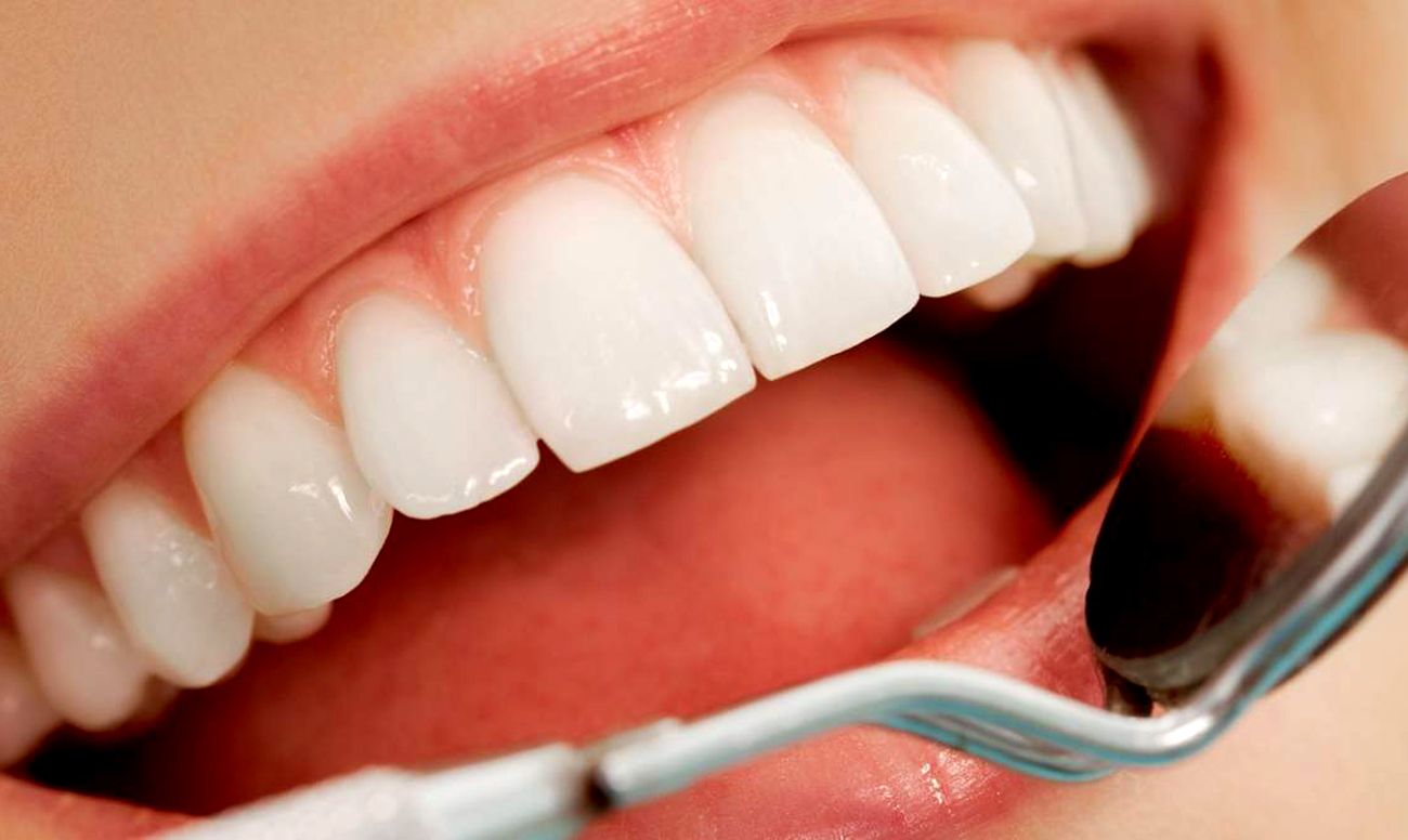 Методи домашнього відбілювання зубів, рецепти, переваги та недоліки кожного методу