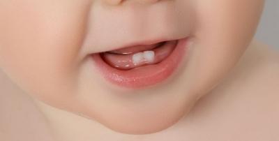 Болять чи молочні зуби у дітей, чому у дитини болить, що робити, як прибрати біль, ніж допомогти знеболити