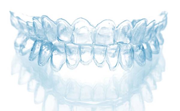Капи для відбілювання зубів: виготовлення та проведення процедури в домашніх умовах з їх допомогою
