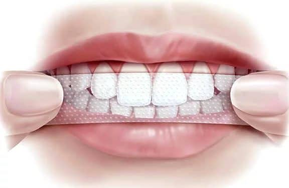 Народні способи відбілювання зубів, різновиди відбілювання зубів будинку