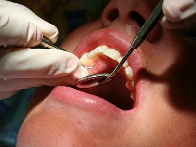 Методи лікування періодонтиту: зубозберігаючі консервативно хірургічні операції, сучасні лазери, пломбування каналів