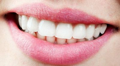 Як відбілити зуби в домашніх умовах без шкоди емалі швидко, безпечно і ефективно, найкращий спосіб для відбілювання
