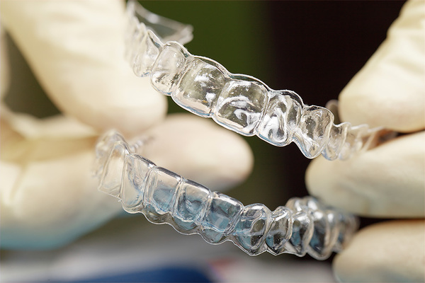 Прозорі брекети: як називаються непомітні скоби на зуби, фото