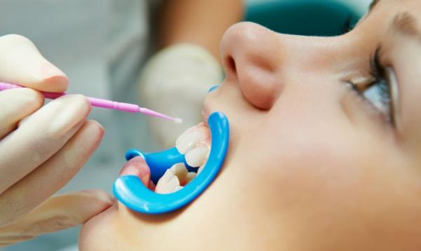Профілактика карієсу у дітей: дитяча зубна паста від кариоза, як захистити зуби, в чому різниця з дорослими, гелі для малюків