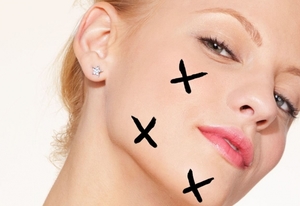 Гормональні прищі на обличчі: причини висипань і як від них позбавитися
