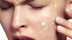 Як позбутися від лущення шкіри обличчя, перевірені методи усунення сухості і лущення