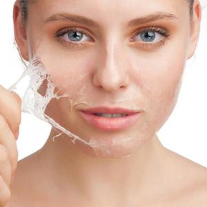 Як позбутися від лущення шкіри обличчя, перевірені методи усунення сухості і лущення