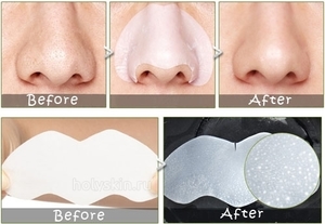 Смужки від чорних крапок на носі: переваги і недоліки очищувальних пластинок проти вугрів