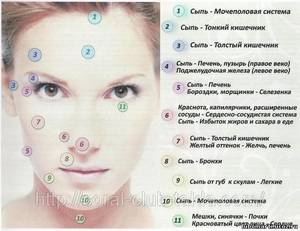 Причини внутрішніх прищів на обличчі: підшкірні прищі на обличчі, на підборідді і щоці