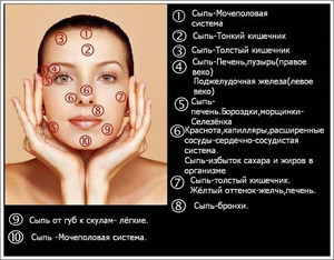 Причини внутрішніх прищів на обличчі: підшкірні прищі на обличчі, на підборідді і щоці