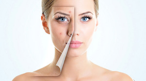 Проблемна шкіра обличчя: причини, лікування прищів і вугрів у домашніх умовах