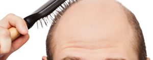 Захист від випадіння волосся: спрей від облисіння для чоловіків і жінок, домашні рецепти зміцнення шевелюри